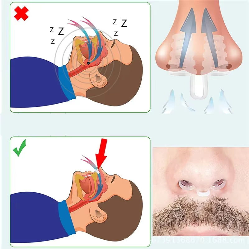10Pcs anti Snoring Nose Clips Sleeping Aid Stop Snore Device Nose Vents Nasal Dilators Sleep Snoring Solution anti Snoring Apnea