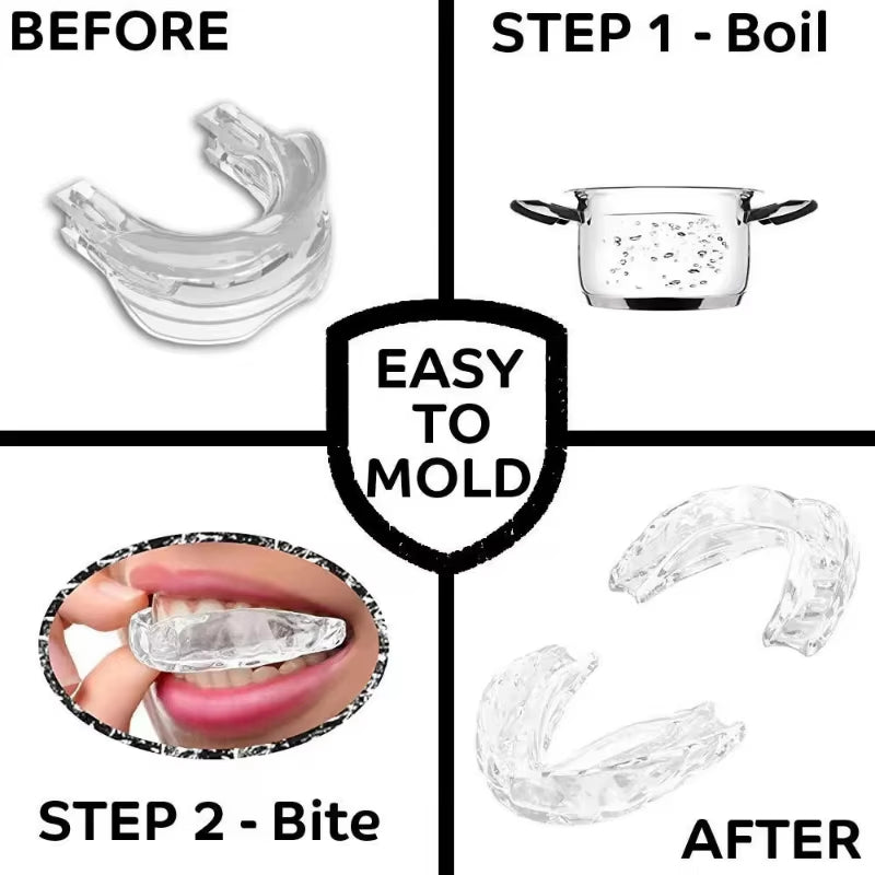 Anti Snoring Bruxism Mouth Guard Teeth Bruxism Sleeping Apnea Guard Snoring Mouth Guard Snoring Device to Stop Snoring