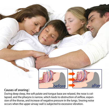 Sleep Strip Better Nose Breathing Anti-Snoring Tape Snoring Aid Device Less Mouth Breathing Health Care for Adults Children