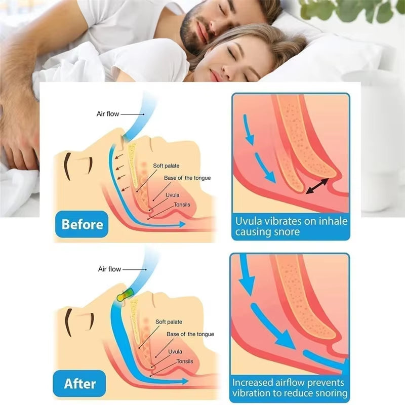 Anti Snoring Device Silicone Nose Clips Magnetic Sleep Tray Sleeping Aid Improve Sleeping Easy Breathe Apnea Guard Night Devices